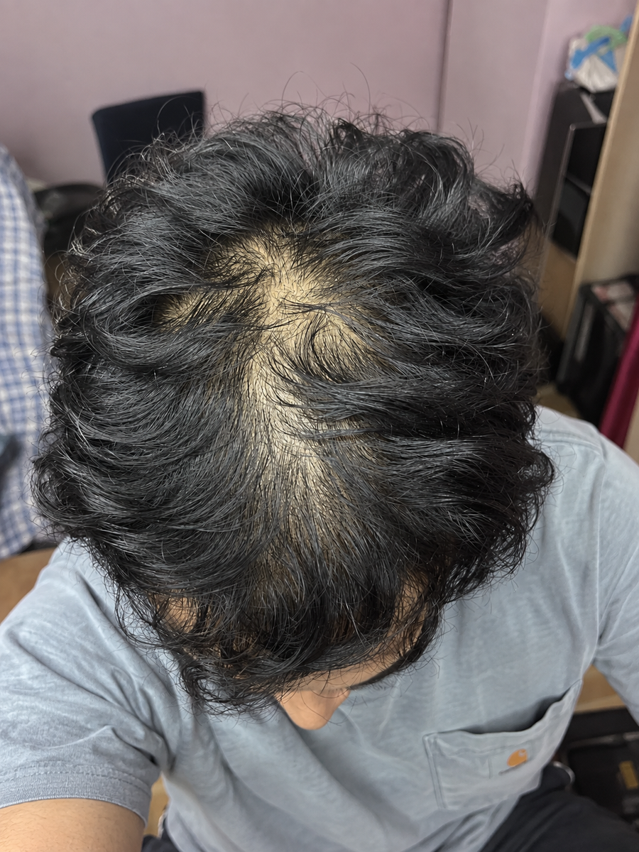 Before