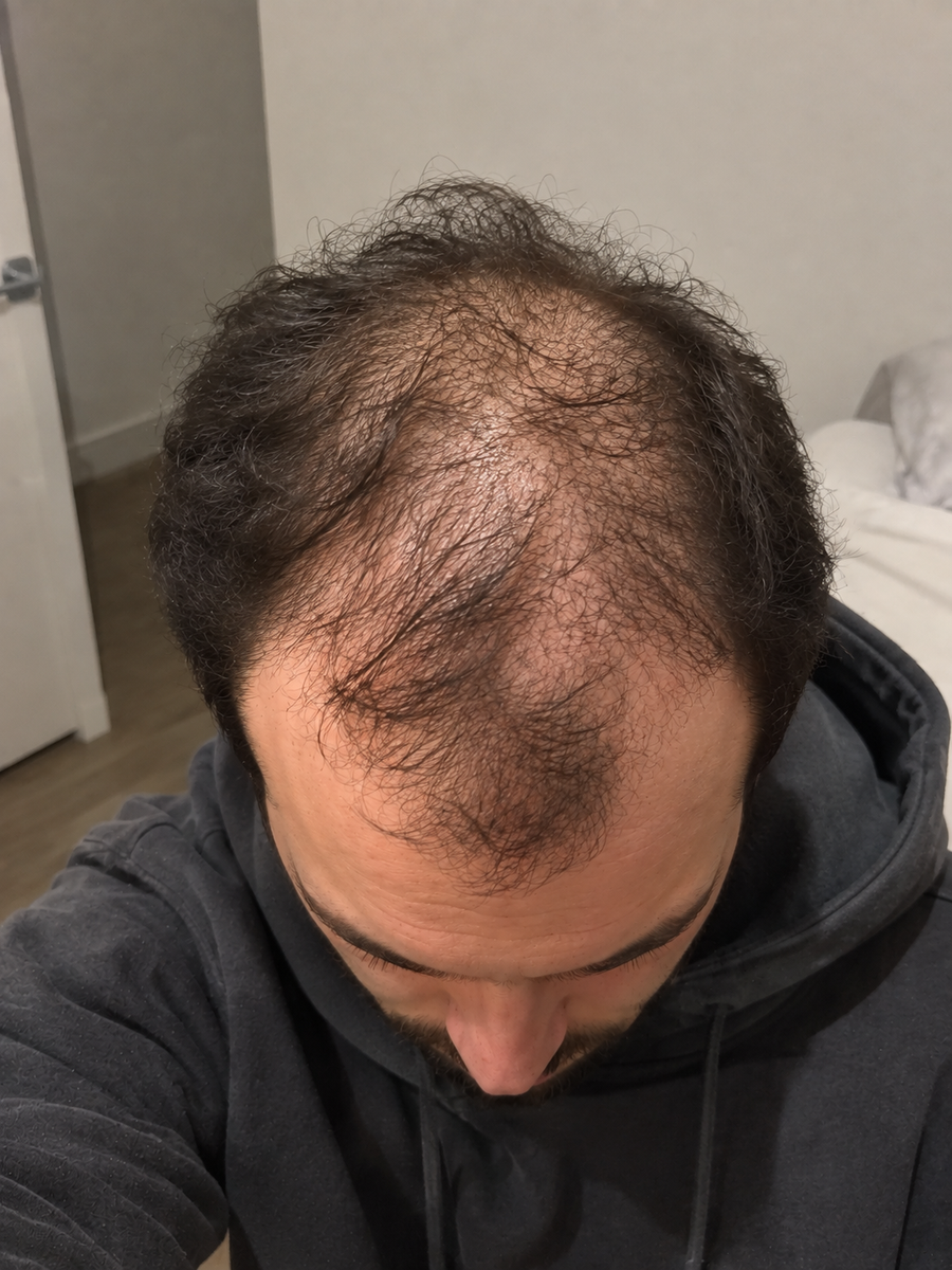 Before